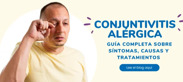 Conjuntivitis Alergica